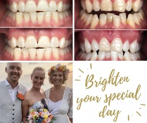 Brighten your special day