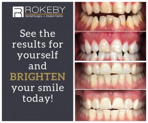 See the results for yourself and BRIGHTEN your smile today!